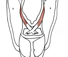 <p><span>INTRINSIC AUXILLARY MUSCLE<br><br>origin: continuation of oblique arytenoid from apex<br><br>insertion: lateral epiglottis<br><br>innervation: X vagus, RLN (recurrent laryngeal nerve)<br><br>function: deflects epiglottis over airway opening to help protect the airway during swallowing; constricts laryngeal opening</span></p>