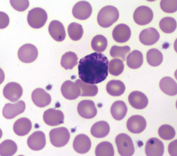 <p>What WBC is this?</p>