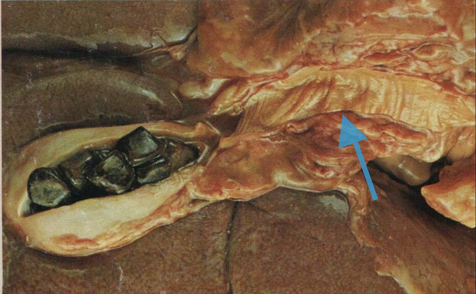 term image