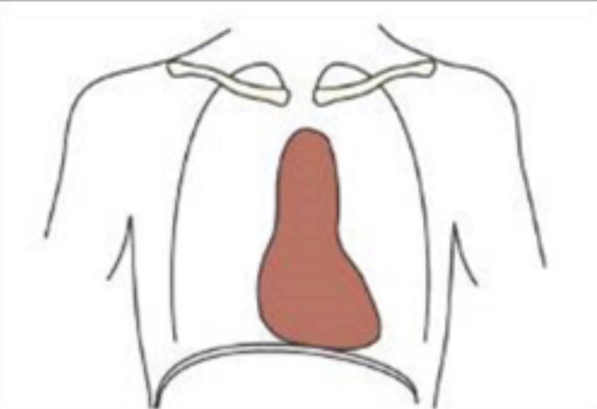 <p>Elongated lungs and Thorax</p><p>Lung apices more curved</p>
