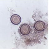<ul><li><p>Cestoda egg of Taenia species </p></li><li><p>from Taenia saginata<span> (beef) or </span>Taenia solium (pork) </p></li><li><p>causes Taeniasis<span> and </span>Cysticercosis</p></li></ul><p></p>