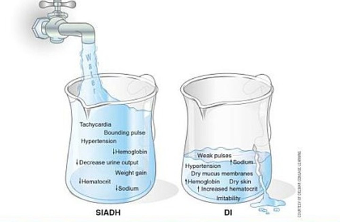<p>-syndrome of inappropriate antidiuretic hormone</p><p>-high levels of ADH (ADH helps keep water)</p><p>-if we have too much ADH, we have too much water in the blood stream, end of with tons of water and not enough sodium</p><p>-hyponatremia: imbalance of water to salt, brain is super sensitive to this, the brain will know that this is off</p><p>-problems happen from being in a hypo-osmolar state (not enough solutes in blood)</p><p>-ADH works on last part of nephron so it gets the last say on deciding on how much water to pull back</p><p>-causes: tumor on pituitary gland, occasionally after surgery</p><p>-Sx: irrational thirst: ratio of solute to water is off so the brain wants us to drink more water, but we already have all this water in the bloodstream. Anorexia and GI problems: wont want to eat when carrying around all this extra water. Dyspnea: extra fluid in blood stream so increase in hydrostatic pressure, fluid could exit into lungs.</p><p>-Severe Sx: changes in LOC, confusion, lethargy, muscle twitching, convulsions</p><p>-NOT A SODIUM PROBLEM, this is a water problem</p><p>-Tx: IV fluids or a hypertonic solution, important to give fluids slowly since a if there is a sudden increase in solutes, water will be attracted from the brain cells so they will shrink and die and will put you into a coma OR water can be rushed into the brain cells too quickly and the brain can burst or die, which leads to coma or death</p>