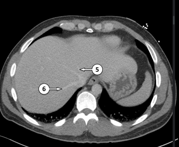 <p>Please label 5 and 6</p>