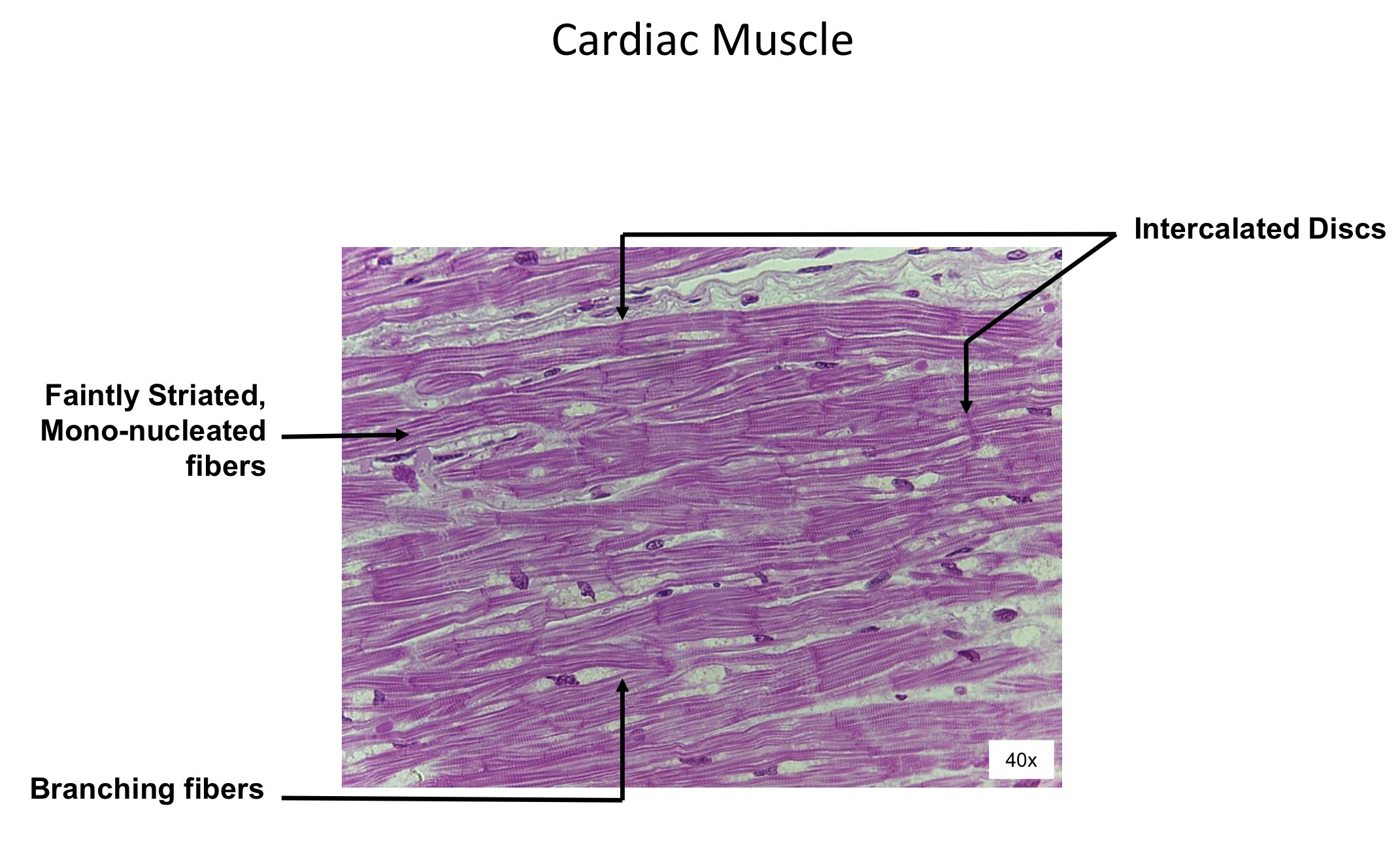 <ol><li><p>Faintly striated, mono- nucleated fibers </p></li><li><p>Branching fibers </p></li><li><p>Interlaced discs</p></li></ol><p></p>