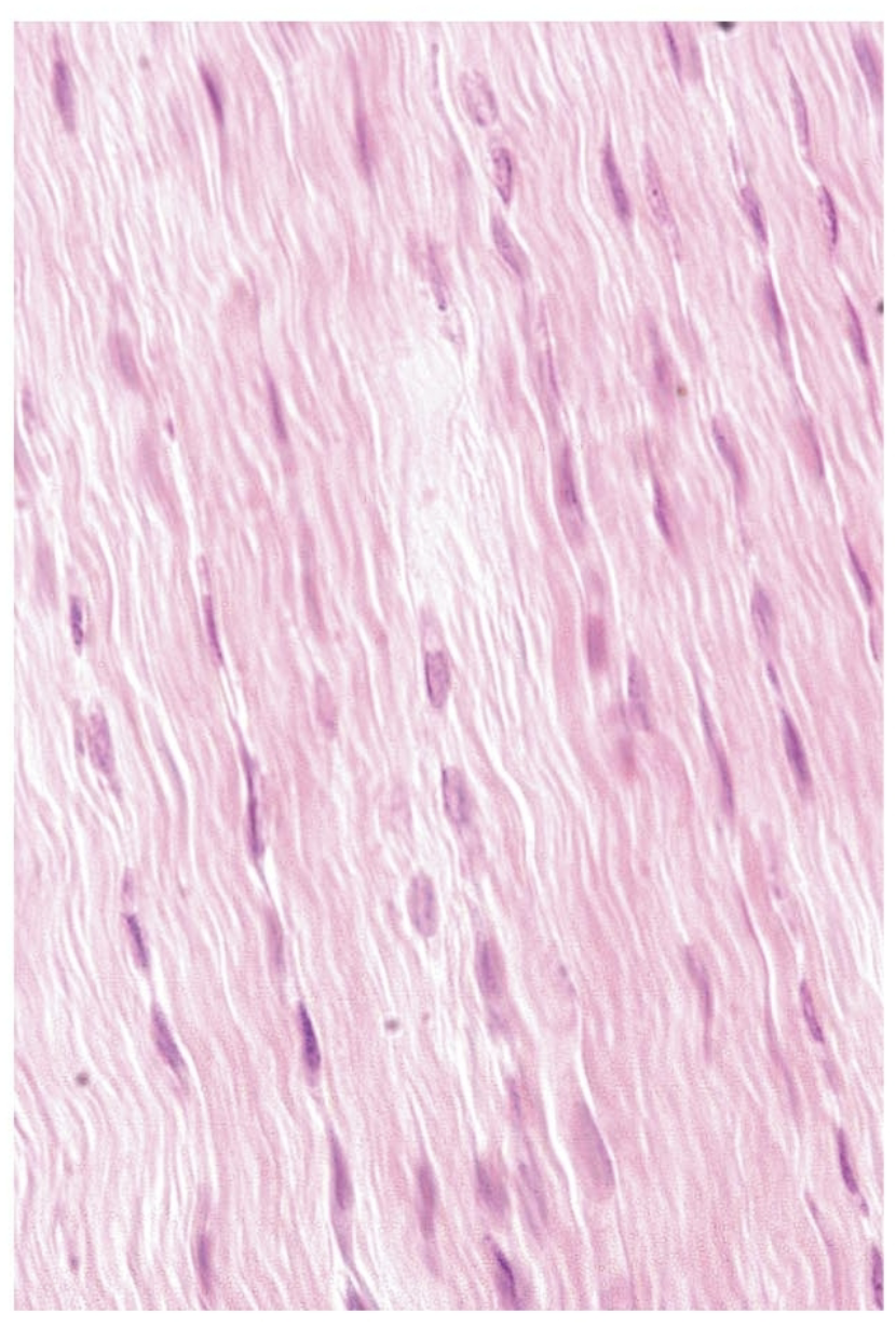 <p>what tissue is this</p>