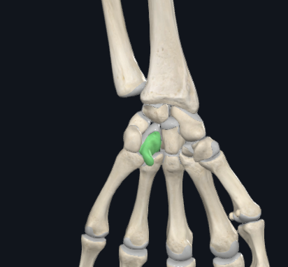 <p>what is this following bone and what section of the hand is it found in?</p>