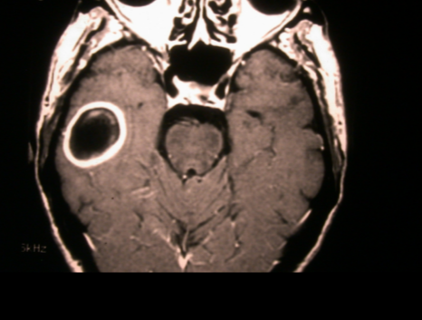 term image