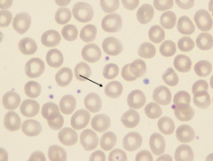 <p>7-8 um</p><p>Biconcave disk. Reddish-pink cytoplasm with area of central pallor 1/3 diameter of cell.</p>