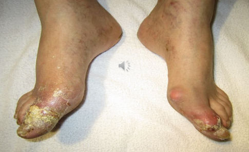 <p>What pathology is shown?</p>