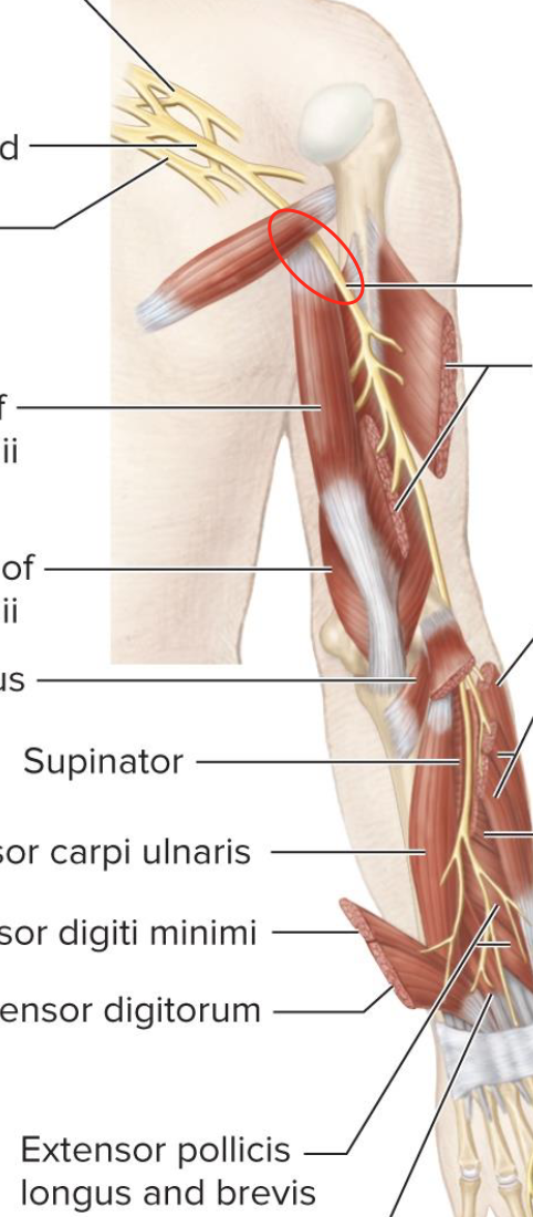 <p>innervates the triceps, supinator, and brachioradialis</p>