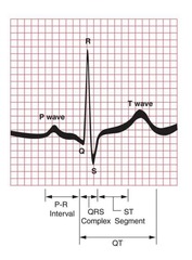 <p>P wave: electrical pulse starting in the SA node</p><p>P-R interval (Q): traveling to AV node</p><p>QRS: 3rd-5th steps are being fired up</p><p>T wave: ventricles relaxing, filling with blood</p>