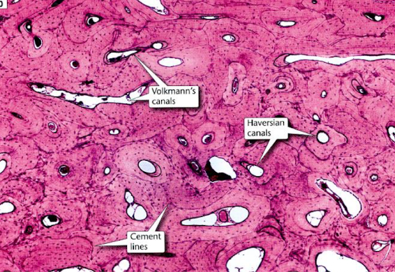 <p>identify type of bone</p>