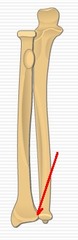 <p>Name Joint</p>
