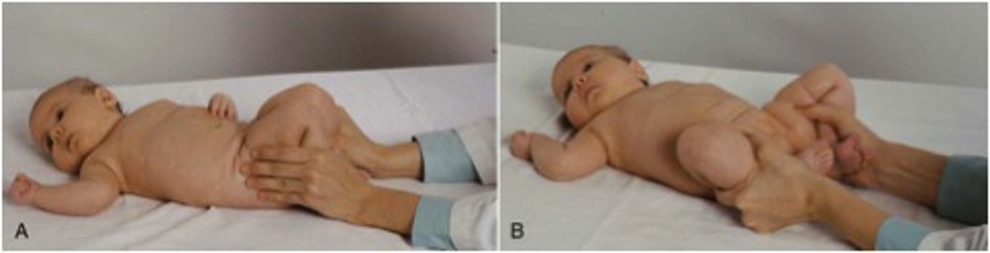 <p>infants, check for congenital hip problems (if clicking, then problem)</p><p>perform every visit until 1 year old</p>