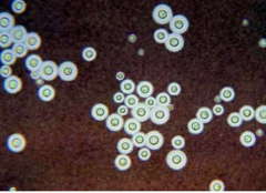 <p>India ink staining of encapsulated yeast in CSF is diagnostic for this pathogen. Urease positive. Can be fatal in immunocompromised patients.</p>