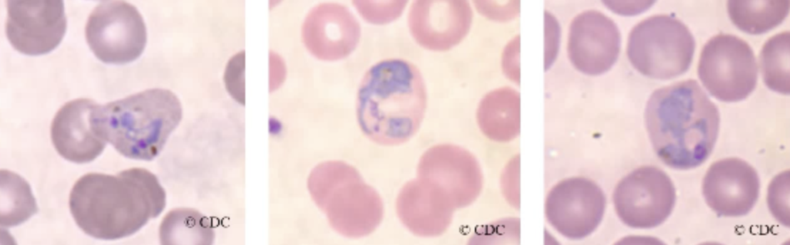 <ul><li><p><span style="background-color: transparent;">a single large chromatin dot is present among the cytoplasmic material.</span></p></li><li><p><span style="background-color: transparent;">The vacuole remains visible and basically intact.</span></p></li><li><p><span style="background-color: transparent;">The presence of brown pigments, which is a remnant of the parasite feeding on the red blood cells hemoglobin, becomes apparent in the site of cytoplasm.</span></p></li><li><p><span style="background-color: transparent;">Schuffner’s dots may also be present.</span></p></li><li><p><span style="background-color: transparent;">take on amoeboid shape</span></p></li></ul><p></p>