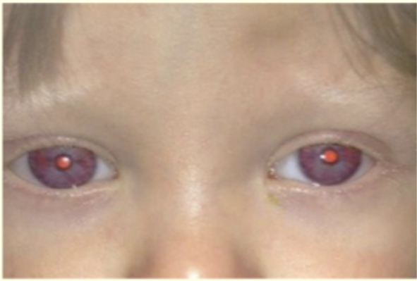 <p>Describe and give diagnosis </p>