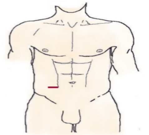 <ol><li><p style="text-align: justify;"><span style="background-color: transparent;">Denomine el nombre de cada incisión y señale cuál es la más eventrógena</span></p></li></ol><p></p>
