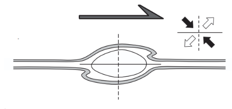<p>Small fold in the foliation around porphyroclasts due to drag</p>
