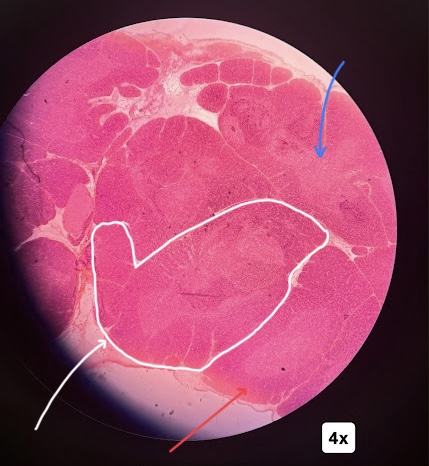 <p>The structure with the white arrows depicts which part of the thymus</p>