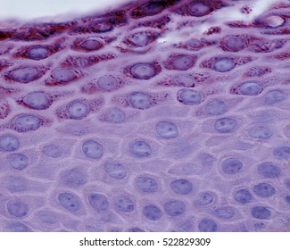 <p>what part of the epidermis is this</p>