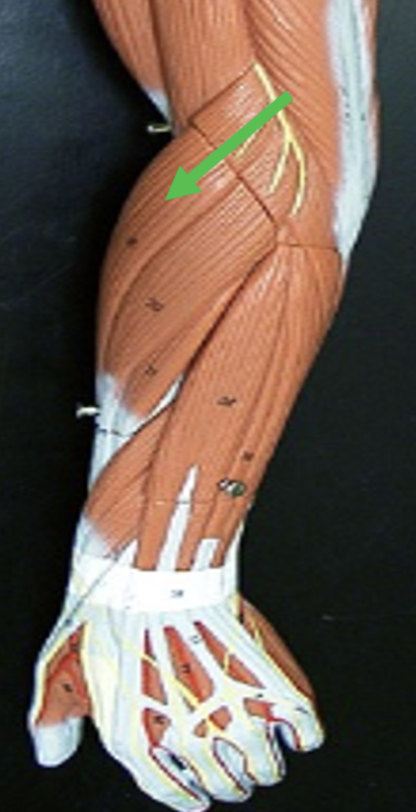 <p>Identify the muscle indicated by the pointer.</p>