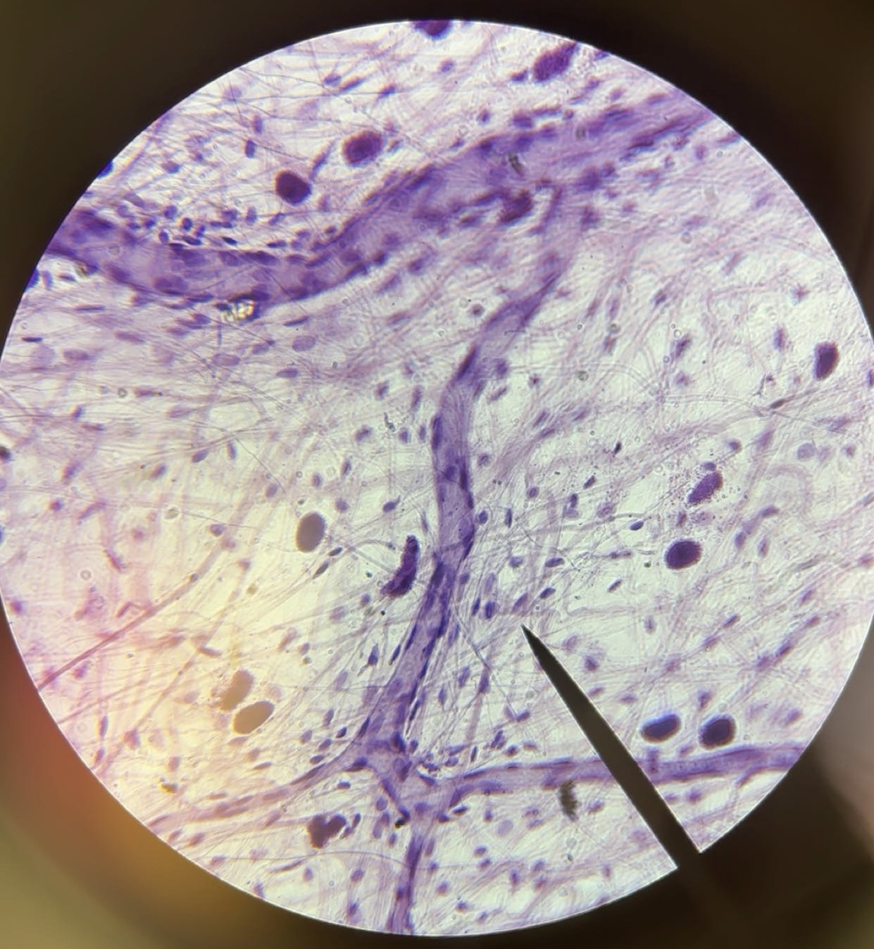 <p>tissue</p>