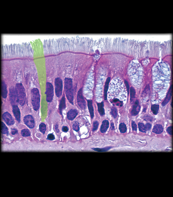term image