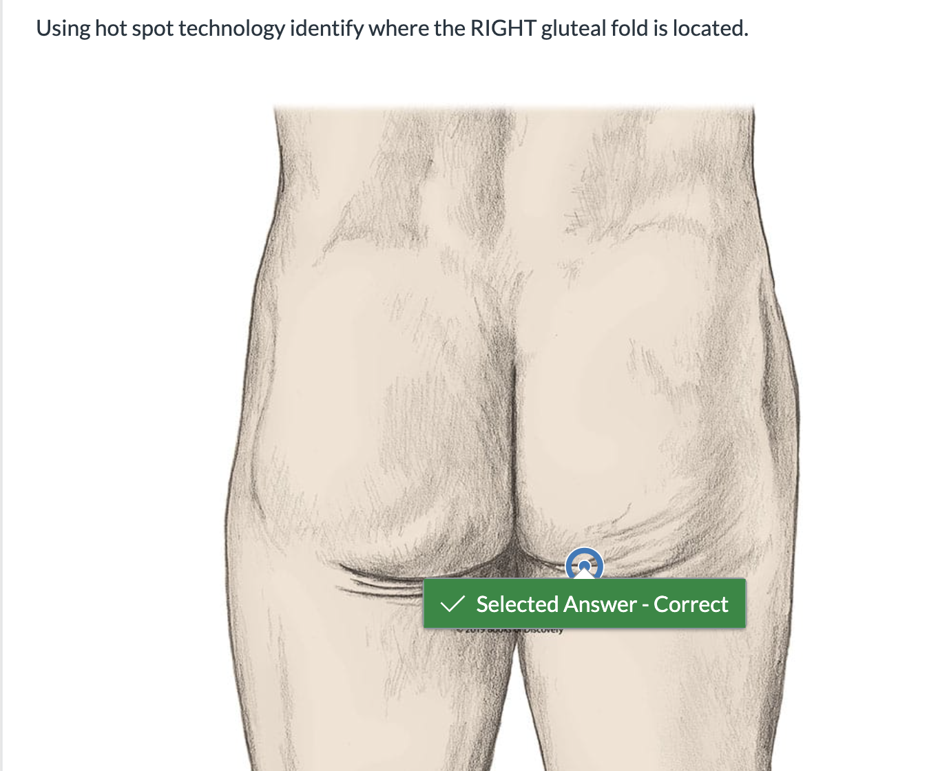 <p><span>Using hot spot technology identify where the RIGHT gluteal fold is located.</span></p>