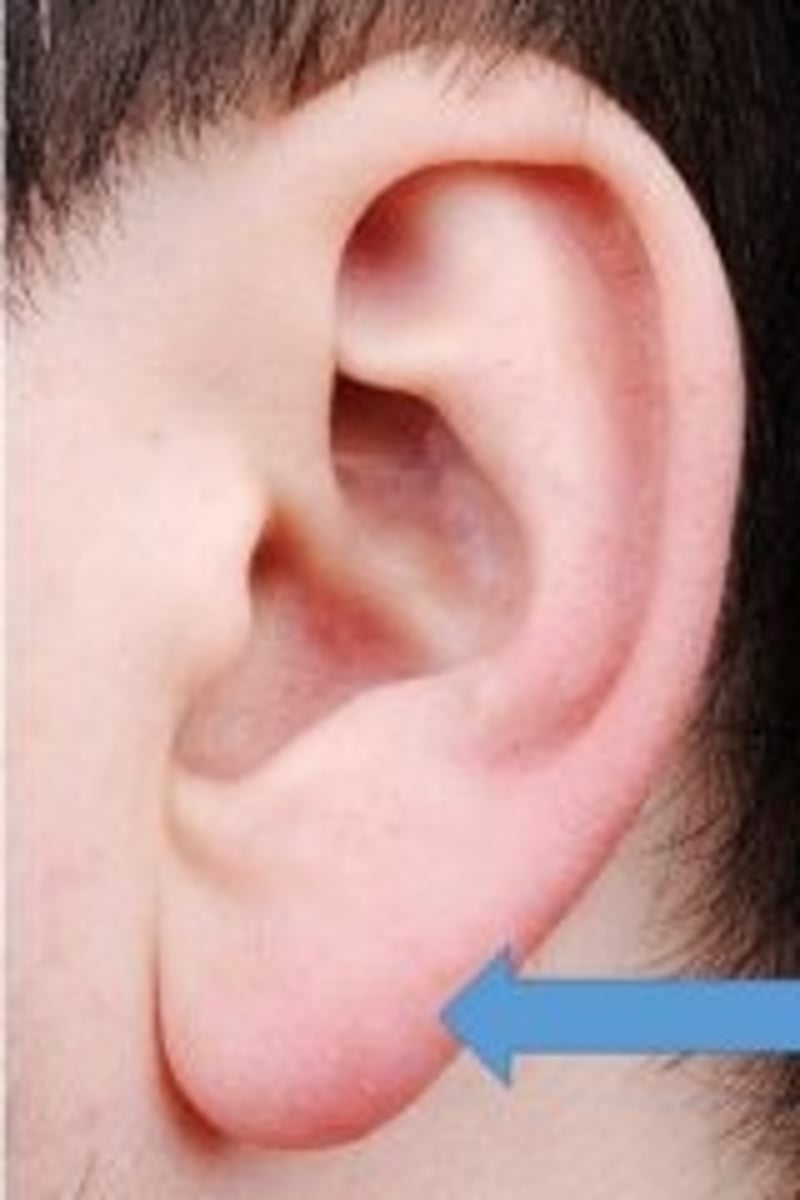 <p>earlobe</p>