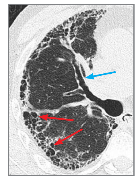 <p>What 2 features are seen here?</p>