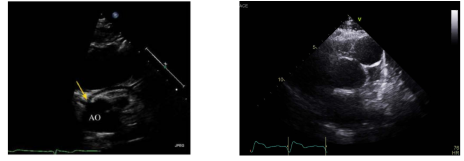 <ul><li><p>Demonstrate the orientation of the semilunar valves</p></li><li><p>Demonstrate the coronary arteries</p></li><li><p>Evaluate ventricular morphology and function</p></li><li><p>Assess for VSDs</p></li></ul><p></p>