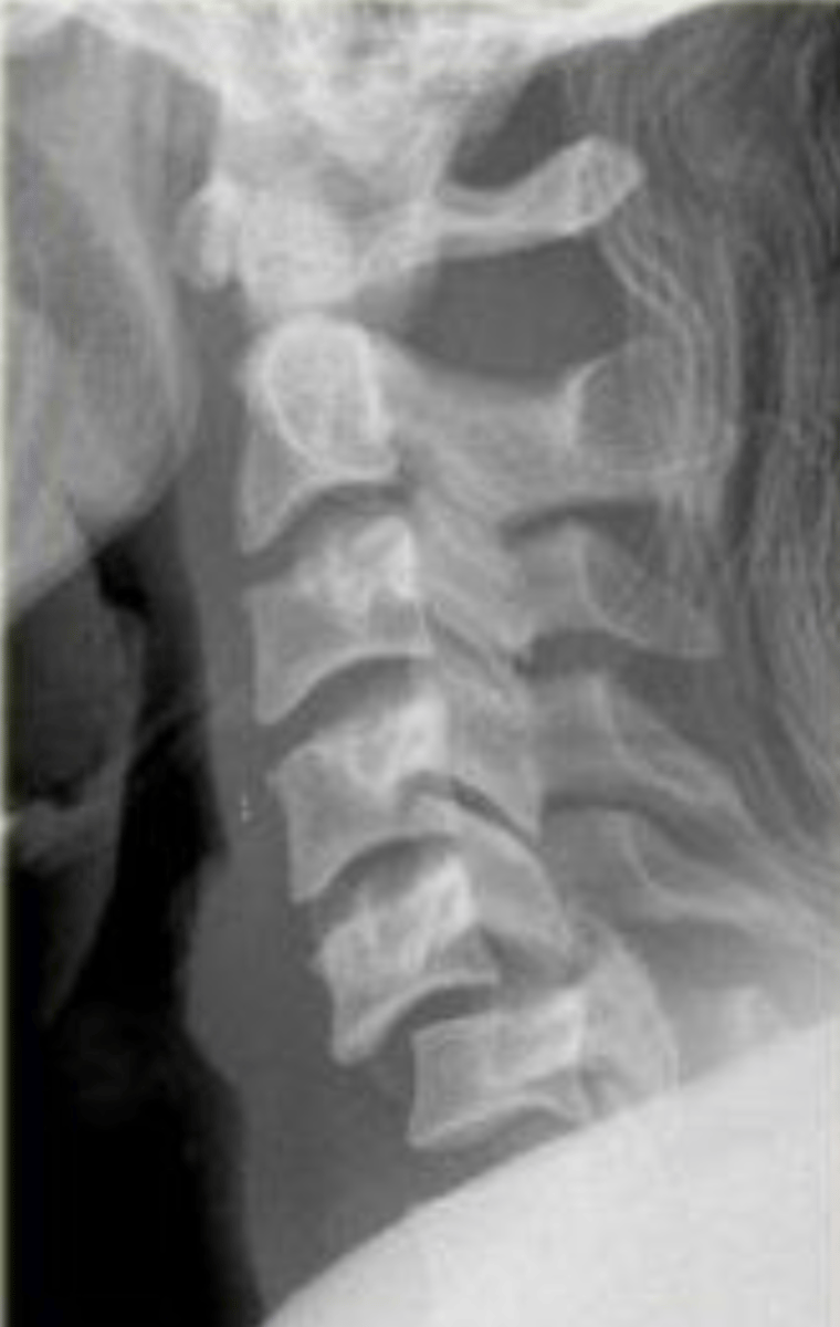 <p>What is the diagnosis?</p>