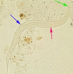 <p>Short buccal canal, bulbar portion of esophagus</p>
