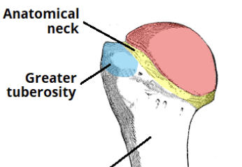 <p>Large bump</p>