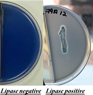 <p>Spirit blue agar test</p>