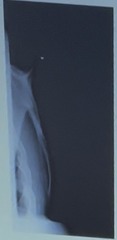 <p>Lateral</p>