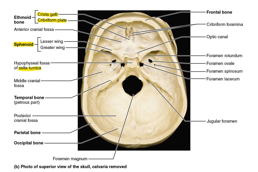 <p>Sphenoid bone landmark: Sella Turcica (houses pituitary gland)</p>