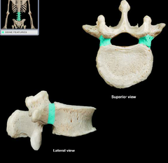 <p>on posterior surface near body of vertebrae </p><p>Attach vertebral arch to vertebral body</p>