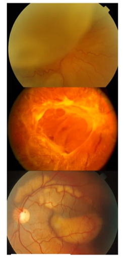 <p>What is this condition</p>