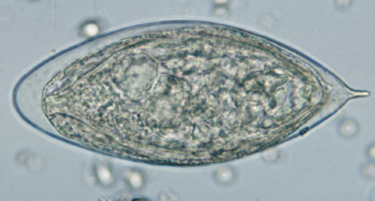 <p>What parasite is this?</p>