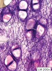 <p>-Elastic fibers </p><p>-Structural</p><p>-Can be found in the ear and epiglottic</p>
