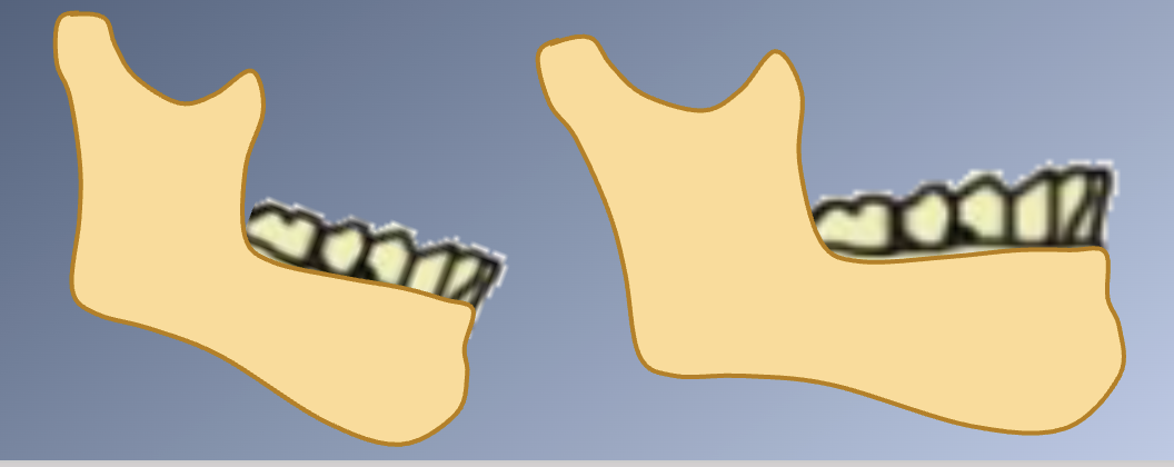<p><span>1. Growth of the mandible away from the maxilla creates a space into which the teeth erupt.</span><br><span>2. The rotational pattern of jaw growth influences the magnitude of tooth eruption.</span><br><span>- Can even influence the DIRECTION of eruption and the A-P position of incisors.</span></p>