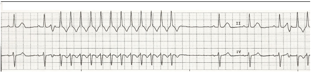 <p>What rhythm is this?</p>