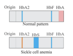 <p>a laboratory test that separates and measures different types of hemoglobin found in the blood.</p>