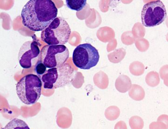 <p>What is the center cell?</p>