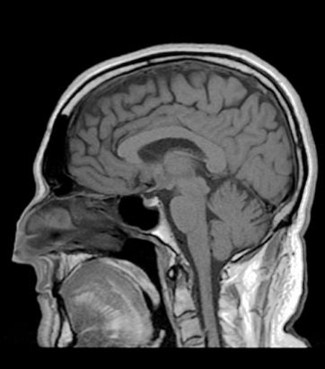 <p>Type of scan, orientation</p>