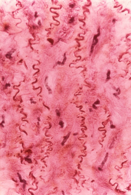 <p>tunica bij elastische arterie</p>