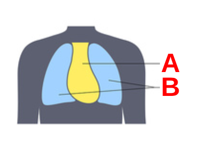 <p>A</p>