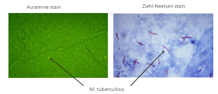 <p>- myobacterium tuberculosis (weakly gram-positive cell wall but waxy coat makes staining difficult; instead we use ACID FAST STAINS</p>